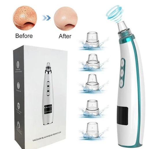 Electric Blackhead Remover – Rechargeable Pore Vacuum Face Cleaner - Infinitygallery.store