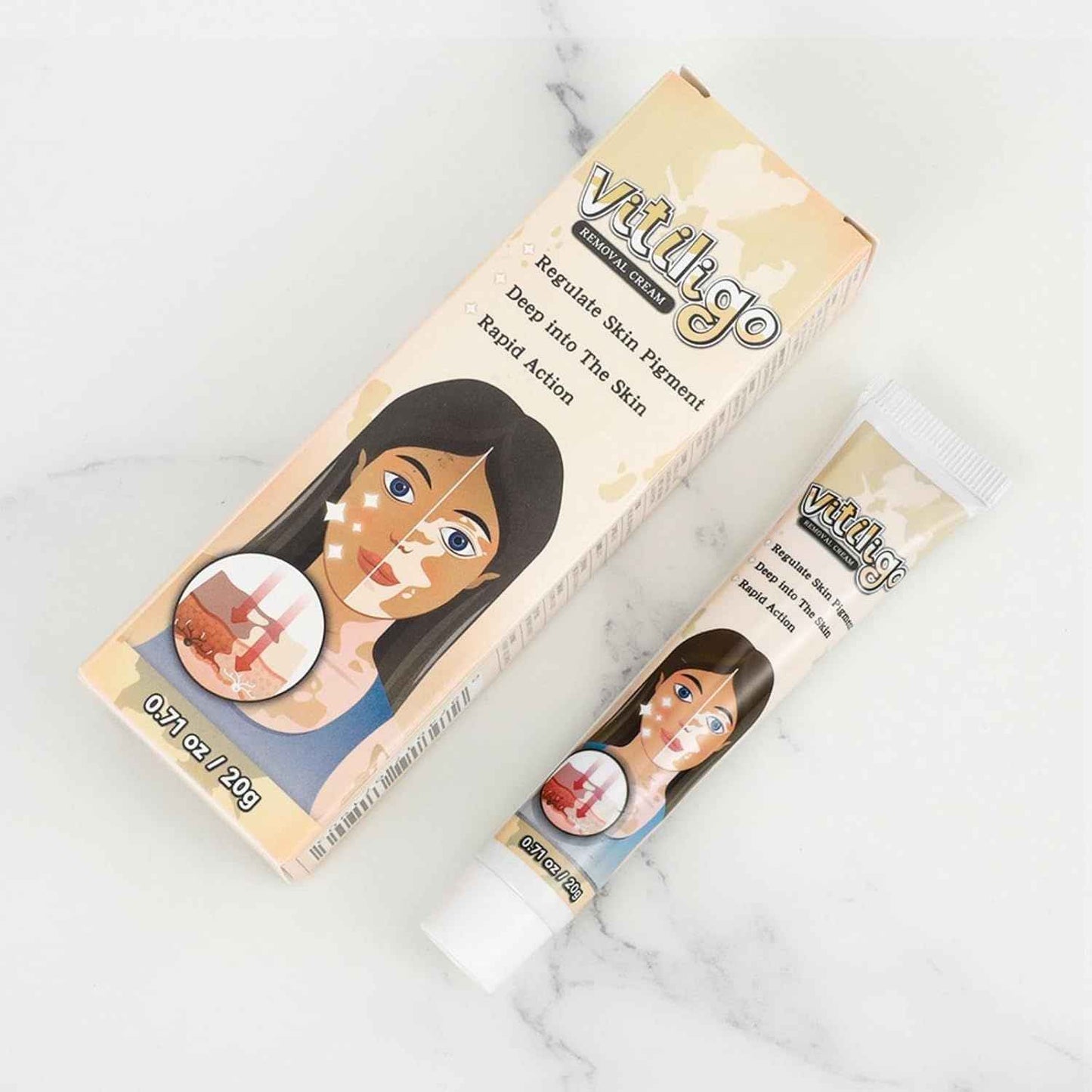 Vitiligo Removal Cream – Restore Skin Pigment & Even Skin Tone Naturally