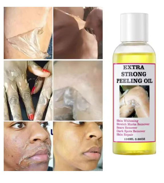 Peeling Oil (110ml) – Gentle Whitening & Skin Renewal Exfoliator - Infinitygallery.store