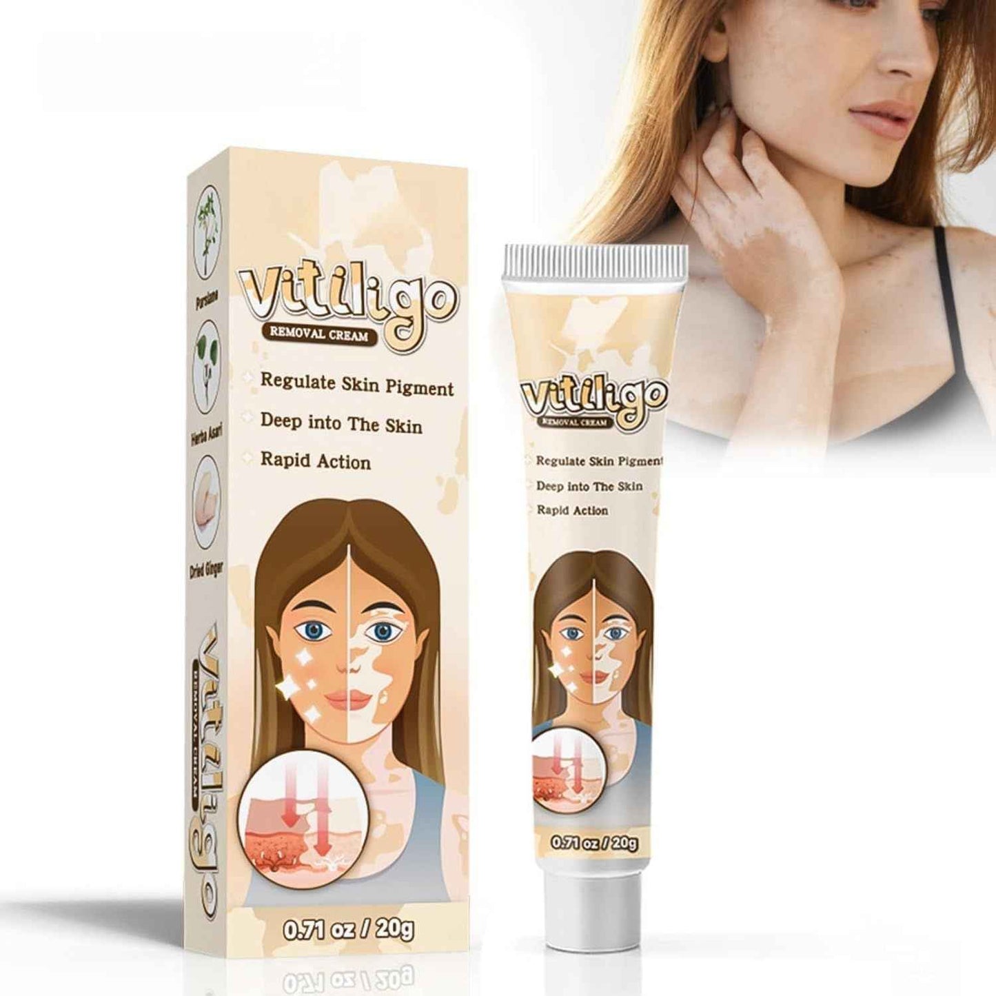 Vitiligo Removal Cream – Restore Skin Pigment & Even Skin Tone Naturally
