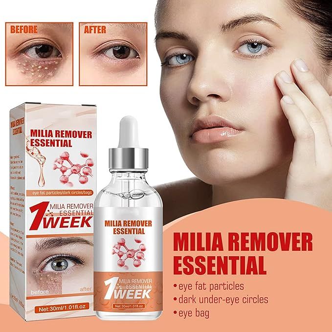 Smooth Milia Remover Serum – 30ml Gentle Skin Smoothing & Hydrating Treatment - Infinitygallery.store