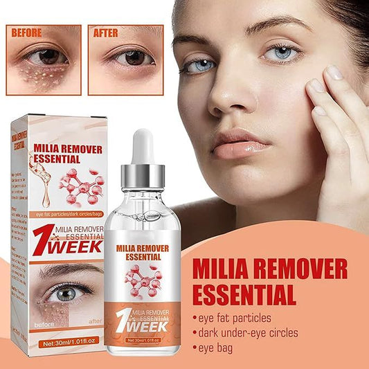 Smooth Milia Remover Serum – 30ml Gentle Skin Smoothing & Hydrating Treatment - Infinitygallery.store