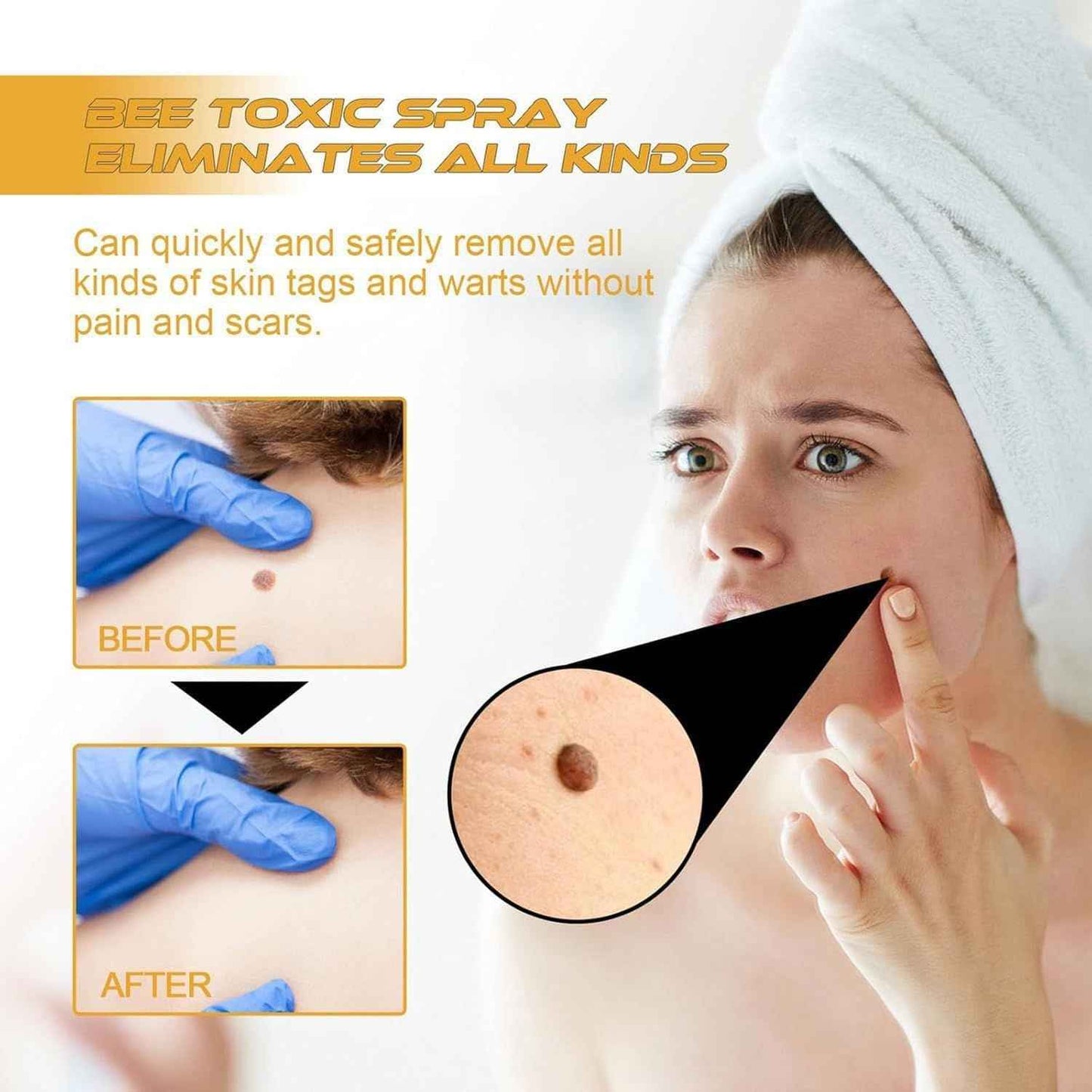 Tag Recede Bees Treatment Spray – Smooth Skin with P-Venom, 20ml