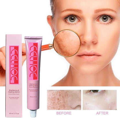 Topicals Faded Serum – Dark Spot Corrector for All Skin Types