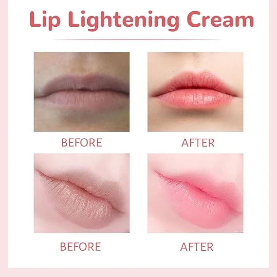 💋 Lip Lightening Cream Balm – Moisture-Locking Brightener for Soft, Even-Toned Lips - Infinitygallery.store