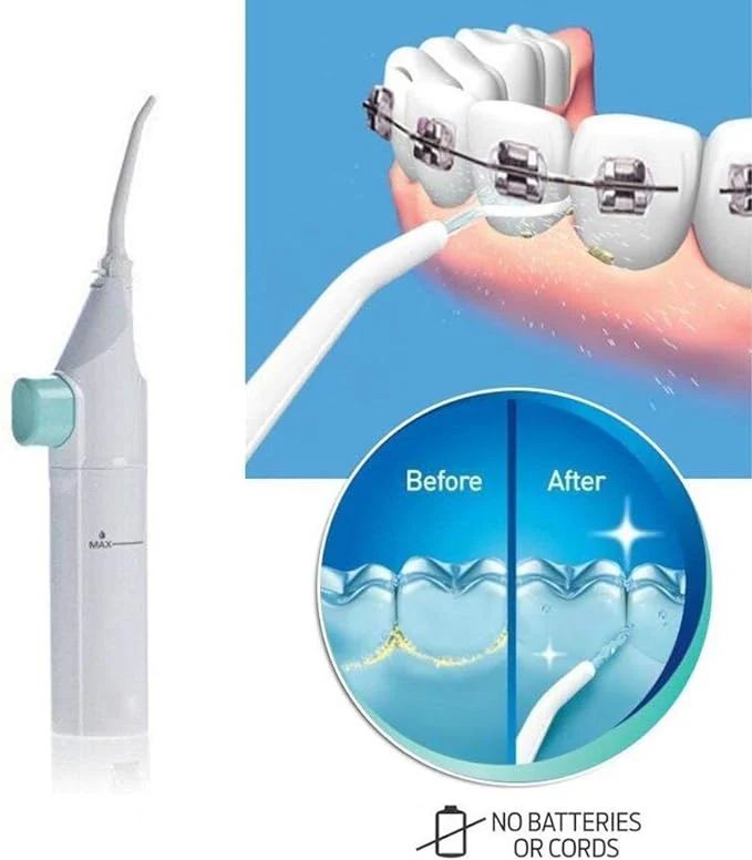 Cordless Dental Water Flosser – Manual Water Jet Tooth Cleaner for Kids & Adults - Infinitygallery.store