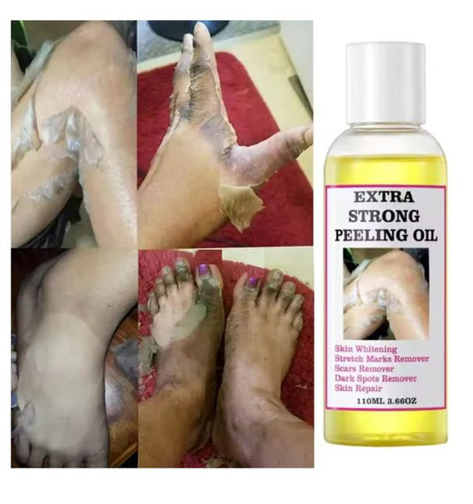Peeling Oil (110ml) – Gentle Whitening & Skin Renewal Exfoliator - Infinitygallery.store