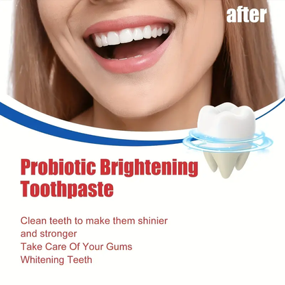 2 Pcs SP-6 Ultra Whitening Toothpaste – Deep Cleaning & Probiotic Brightening - Infinitygallery.store