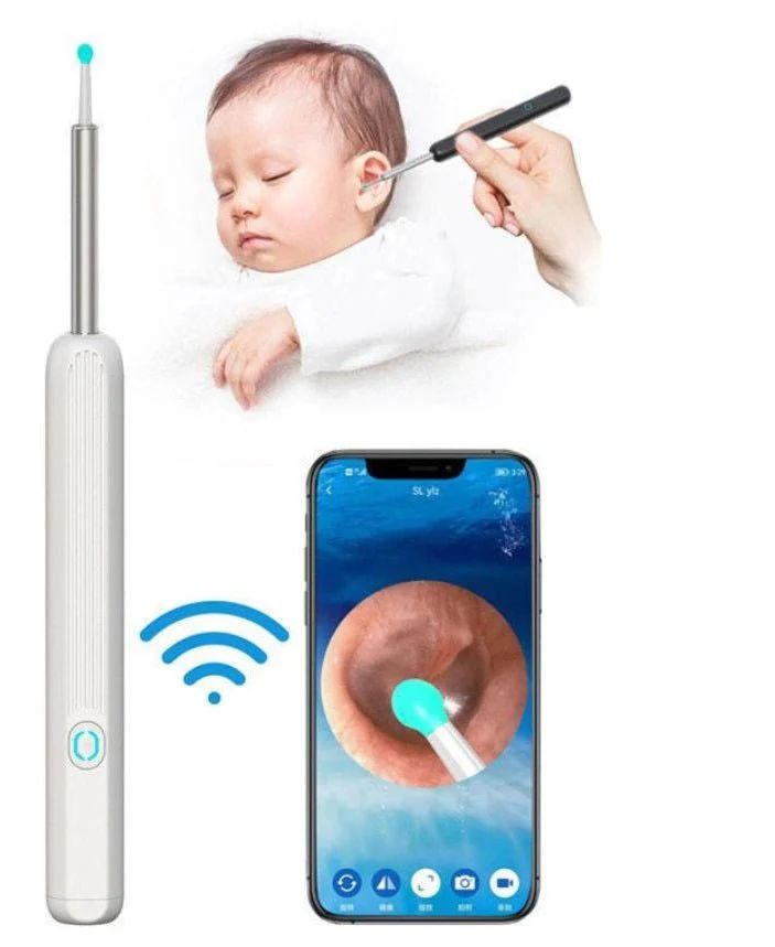 Wireless HD Earwax Removal Kit with Camera – iOS & Android Compatible, Type-C Rechargeable - Infinitygallery.store