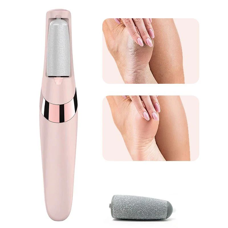 Rechargeable Electric Pedicure Foot File – Callus Remover with Dual Speed & Rollers - Infinitygallery.store
