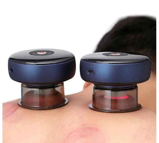 Electric Vacuum Cupping Massager with Red Light Therapy – 6 Modes, Rechargeable, Portable Full-Body Relief | Infinity Gallery