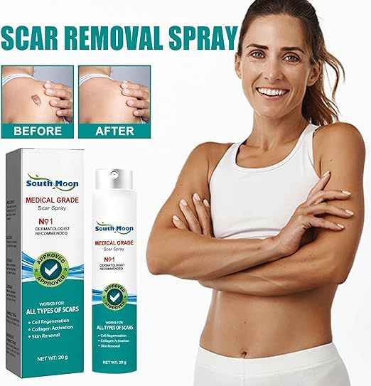 Proregen Medical Scar Removal Spray – Advanced Healing for Acne, Surgical & Burn Scars