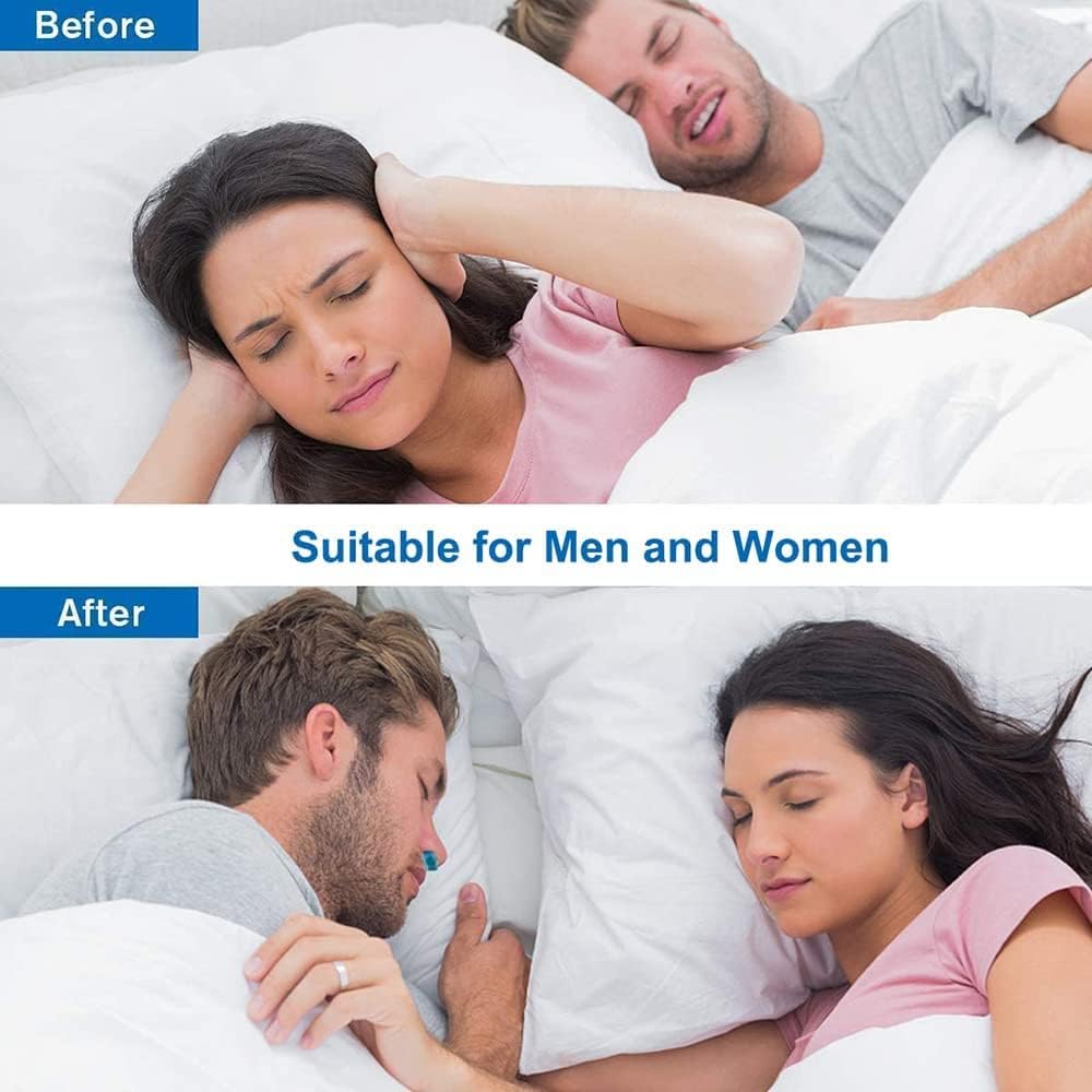 Anti Snoring Device – Comfortable Nasal Dilator with Air Filter - Infinitygallery.store