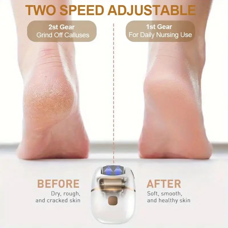 Electric Foot Grinder – Smooth Feet in Minutes - Infinitygallery.store
