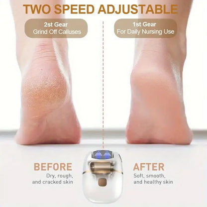 Electric Foot Grinder – Smooth Feet in Minutes - Infinitygallery.store