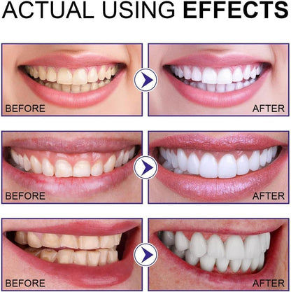 2 Pcs Teeth Whitening Powder – Instant Bright Smile - Infinitygallery.store